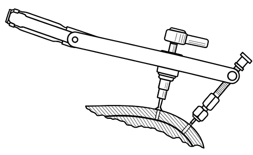 The best way to remove a stuck screw using the johnson bar tool called eL Brutus made by B & L International